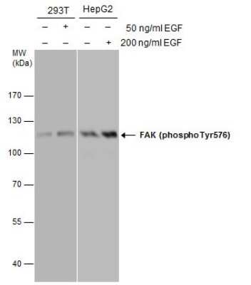 Western Blot: FAK [p Tyr576] Antibody [NBP3-13071]